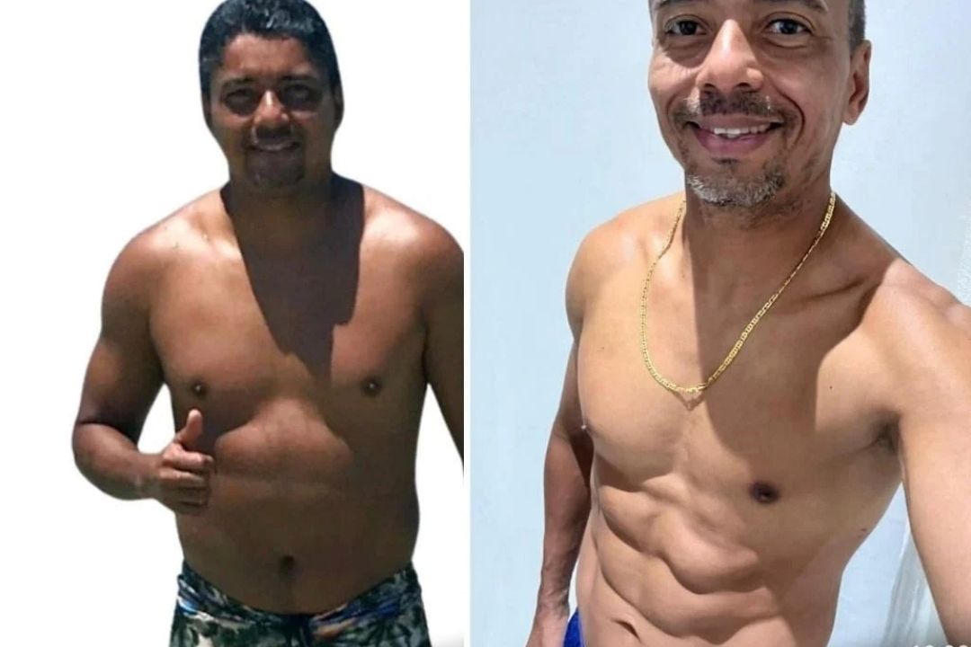 Paciente satisfeita — Clínica Performance